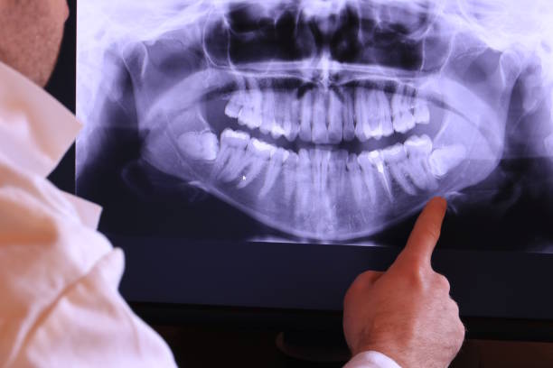 Best Emergency Care for Gum Disease in Marrero, LA